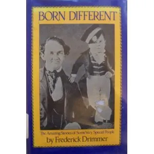 Born Different: Amazing Stories of Very Special People